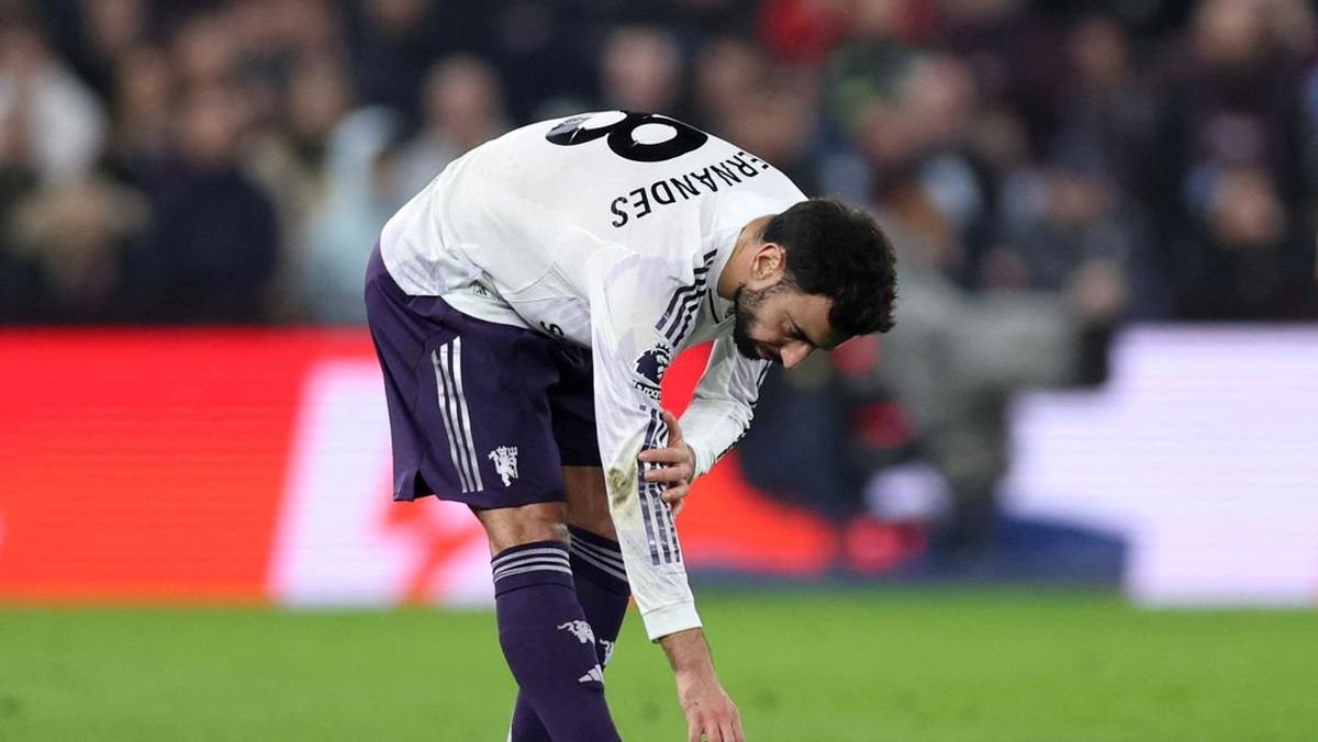 Amorim Tak Gentar! Manchester United Tetap Percaya Diri Meski Tanpa Bruno Fernandes