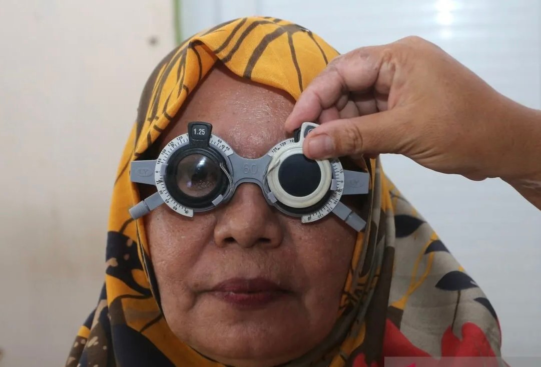 Cegah Katarak, Dokter Mata Sarankan Penggunaan Kacamata Pelindung Sinar UV